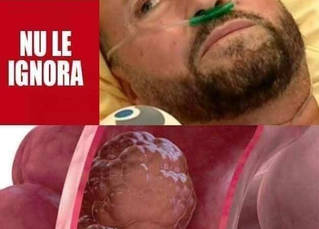 Șase simptome ale cancerului de colon pe care nimeni nu le bagă în seamă. Cătălin Botezatu le-a ignorat și a fost la un pas să își piardă viața