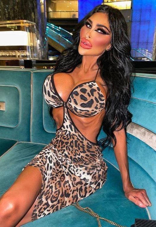 A cheltuit 100.000 de dolari pe operații ca să aibă aceste trăsături. Cum arăta înainte să fie o păpușă Barbie de plastic