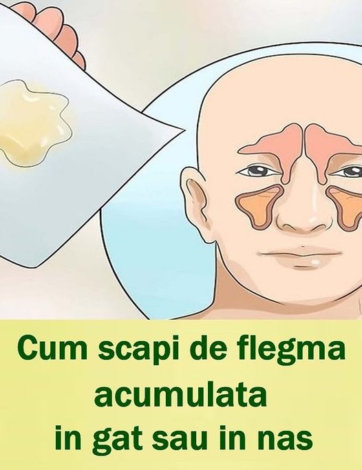 Cum scapi de flegma acumulată în gât sau în nas  7 tratamente naturiste pe care e bine să le știi