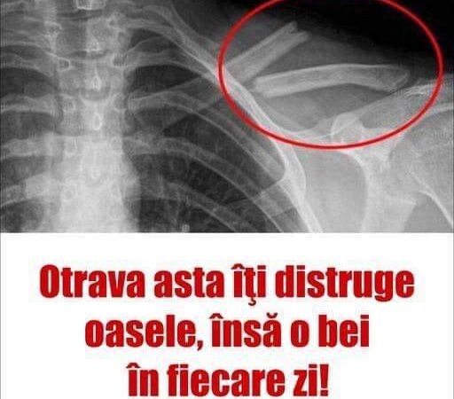 Otrava asta îţi distruge oasele însă o bei în fiecare zi Sigur nu ştiai asta