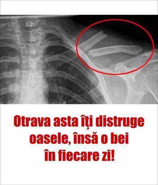 Otrava asta îţi distruge oasele însă o bei în fiecare zi Sigur nu ştiai asta