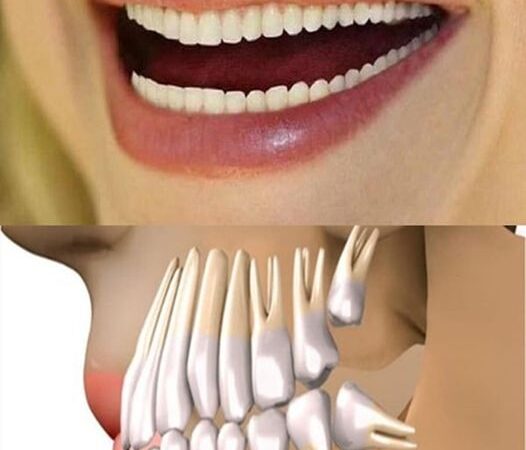 Adio Implanturi Dentare Dinții Care Cresc În Doar 9 Săptămâni. Descoperirea SECOLULUI