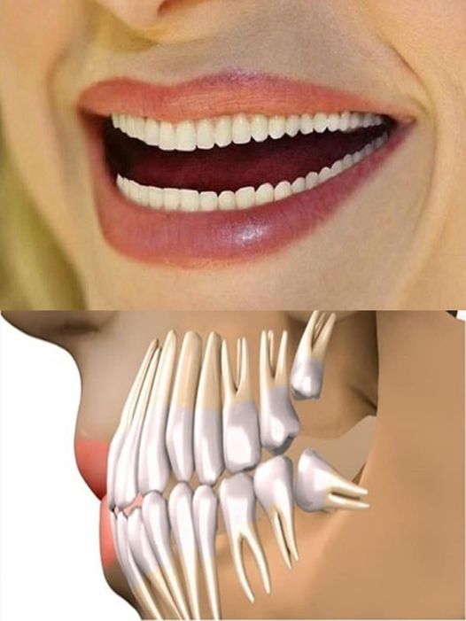 Adio Implanturi Dentare Dinții Care Cresc În Doar 9 Săptămâni. Descoperirea SECOLULUI