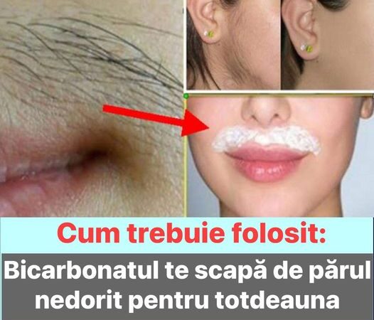 Bicarbonatul te scapă de părul nedorit pentru totdeauna  Cum trebuie folosit