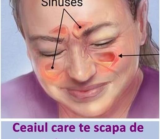 Ceaiul care te scapă de streptococul în gât gripă și infecțiile sinusurilor